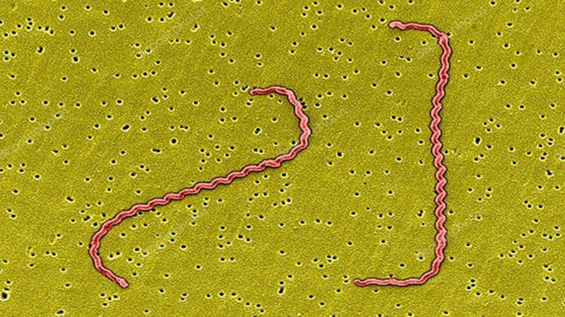 Nhiễm xoắn khuẩn vàng da Leptospira: Nguyên nhân, triệu chứng, chẩn đoán và điều trị