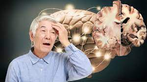 Alzheimer. Nguyên nhân, triệu chứng, chẩn đoán và điều trị