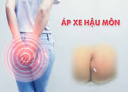 Áp xe hậu môn. Nguyên nhân, triệu chứng, chẩn đoán và điều trị