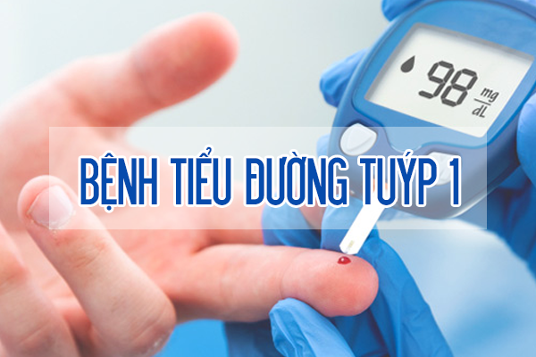 Tiểu đường tuýp 1: Nguyên nhân, triệu chứng, chẩn đoán và điều trị