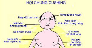 Hội chứng Cushing: Nguyên nhân, triệu chứng, chẩn đoán và điều trị