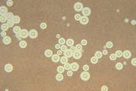 Nhiễm nấm Cryptococcus: Nguyên nhân, triệu chứng, chẩn đoán và điều trị