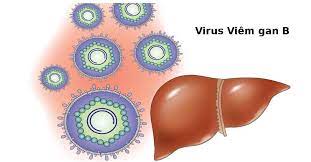 Viêm gan B: Nguyên nhân, triệu chứng, chẩn đoán và điều trị