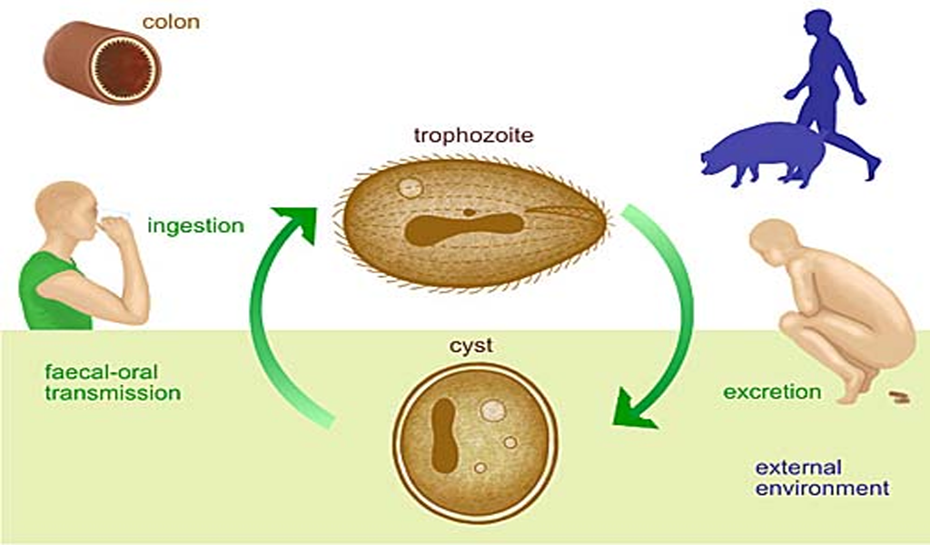 Lỵ do Balantidium: Nguyên nhân, triệu chứng, chẩn đoán và điều trị