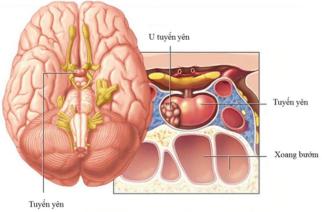 Đau đầu, tay chân đau buốt, to lên bất thường… cảnh giác với bệnh to đầu chi