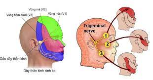 Đau dây thần kinh sinh ba. Nguyên nhân, triệu chứng, chẩn đoán và điều trị