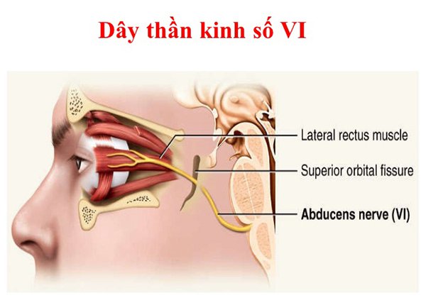 Liệt dây thần kinh số 6: Nguyên nhân, triệu chứng, chẩn đoán và điều trị