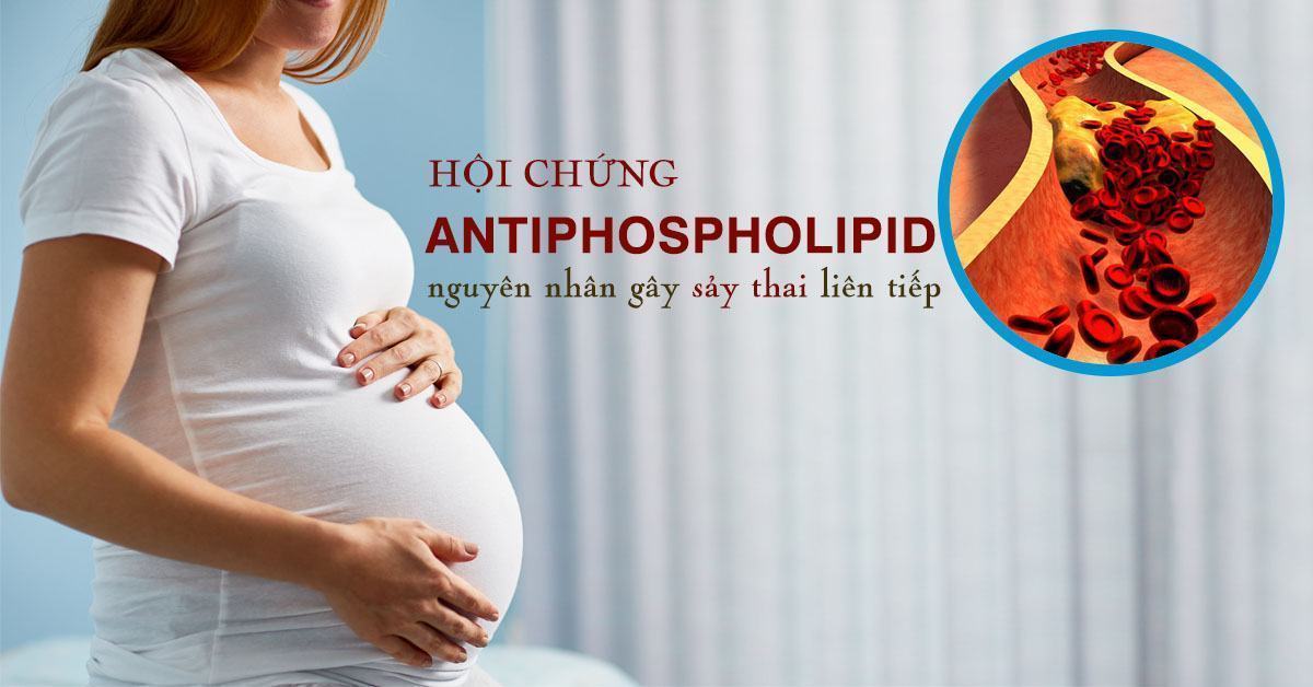 Hội chứng antiphospholipid: Nguyên nhân, triệu chứng, chẩn đoán và điều trị