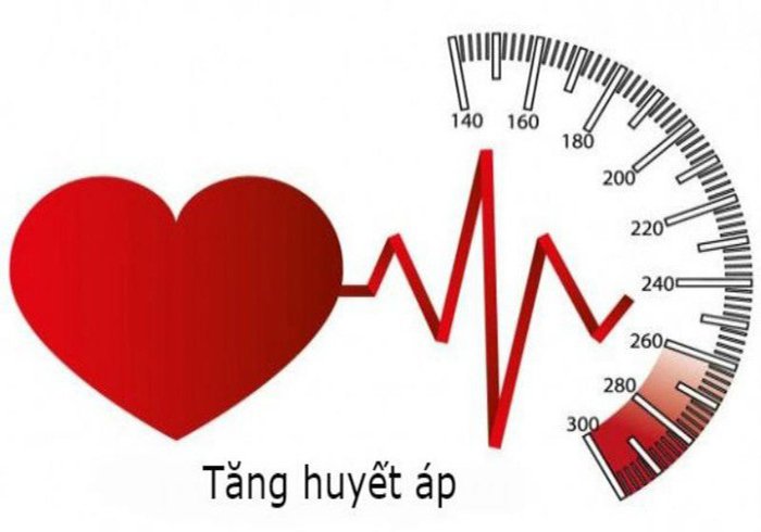 Tăng huyết áp: Nguyên nhân, triệu chứng, chẩn đoán và điều trị