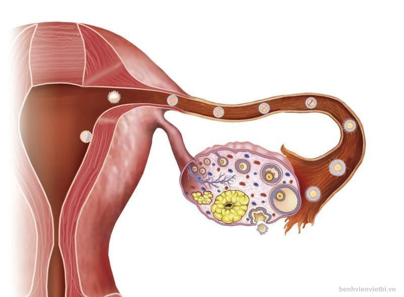 Suy buồng trứng: Nguyên nhân, triệu chứng, chẩn đoán và điều trị